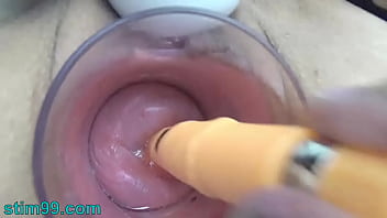extreme fisting and toilet brush insertions