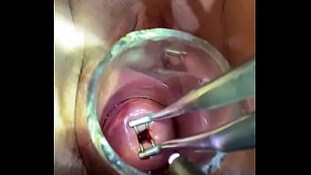 bdsm insertion of proctoscope by doctor gay