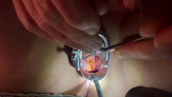 male anal speculum painful